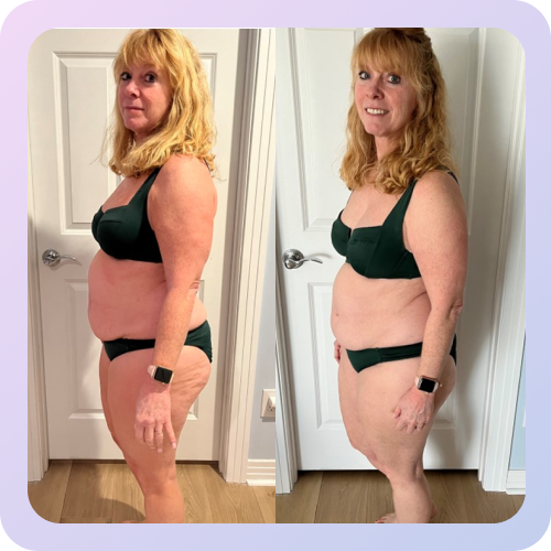 Before and after 4