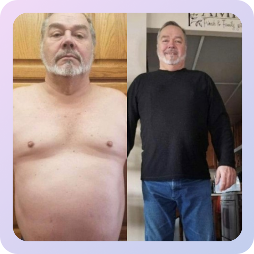 Before and after 10