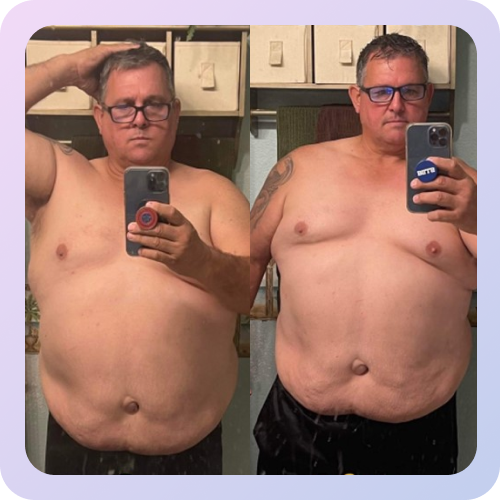 Before and after 10